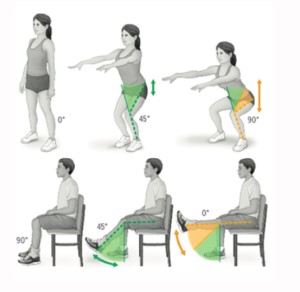 Priorize exercícios de cadeia fechada para montar treinos para condromalácia patelar